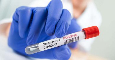 Bahía registró 919 nuevos contagios de coronavirus